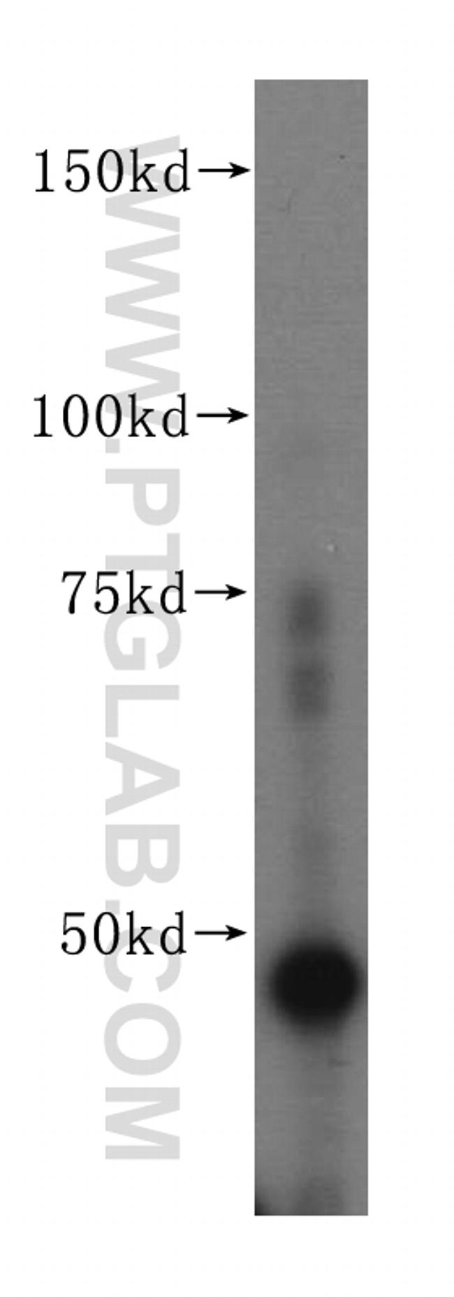 FEN1 Antibody in Western Blot (WB)