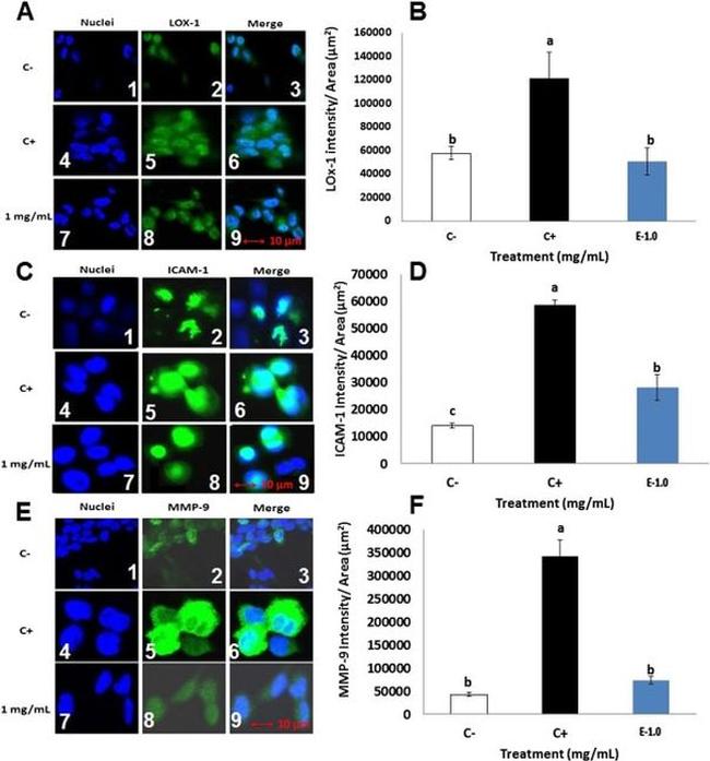 ICAM-1 Antibody in Immunocytochemistry (ICC/IF)