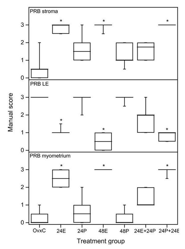 Progesterone Receptor Antibody in Immunohistochemistry (IHC)