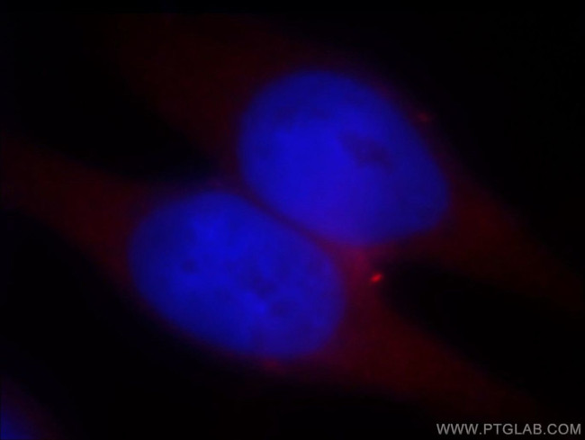 TARS Antibody in Immunocytochemistry (ICC/IF)