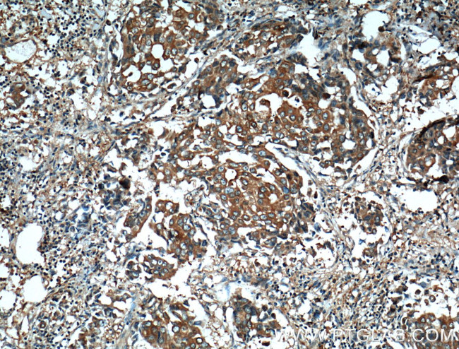 TARS Antibody in Immunohistochemistry (Paraffin) (IHC (P))