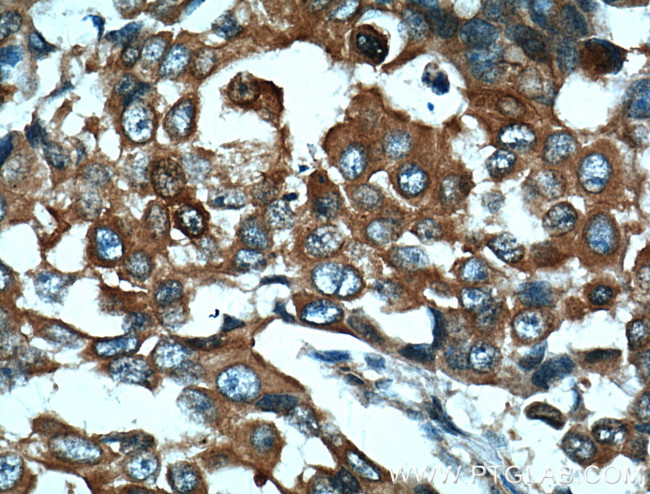 TARS Antibody in Immunohistochemistry (Paraffin) (IHC (P))