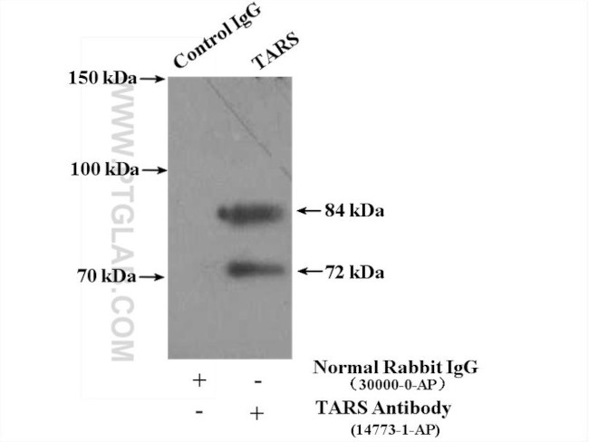 TARS Antibody in Immunoprecipitation (IP)