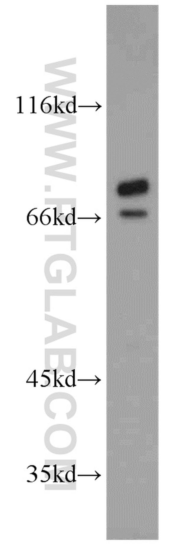 TARS Antibody in Western Blot (WB)