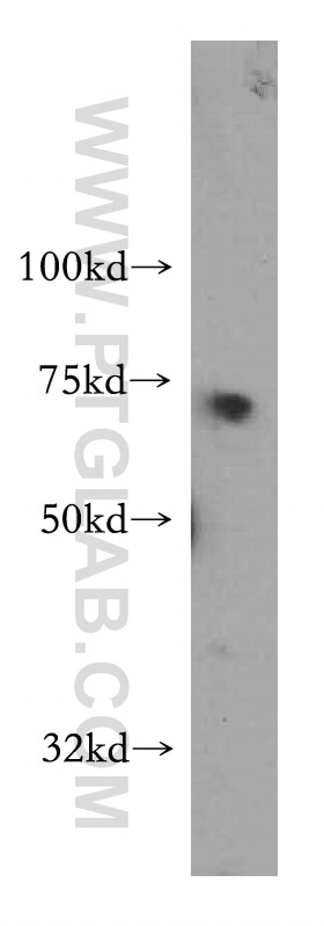 TARS Antibody in Western Blot (WB)