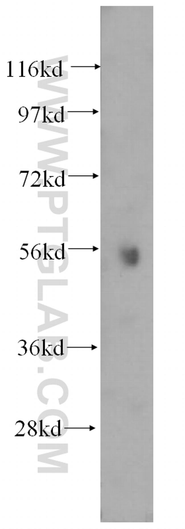 ATP6V1B1 Antibody in Western Blot (WB)