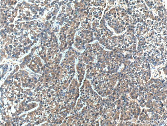 ERLIN2 Antibody in Immunohistochemistry (Paraffin) (IHC (P))