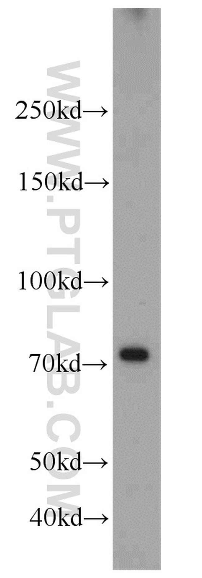 RFX3 Antibody in Western Blot (WB)