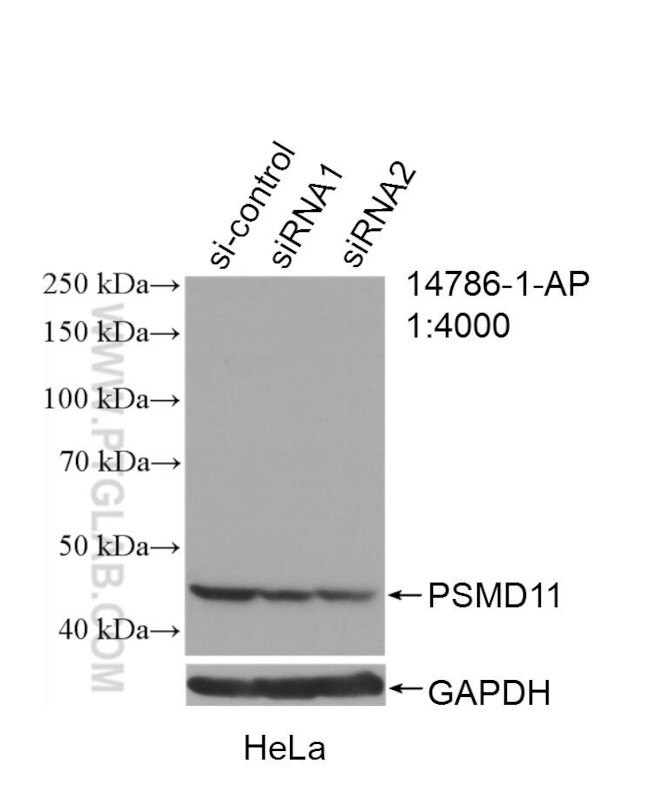 PSMD11 Antibody in Western Blot (WB)