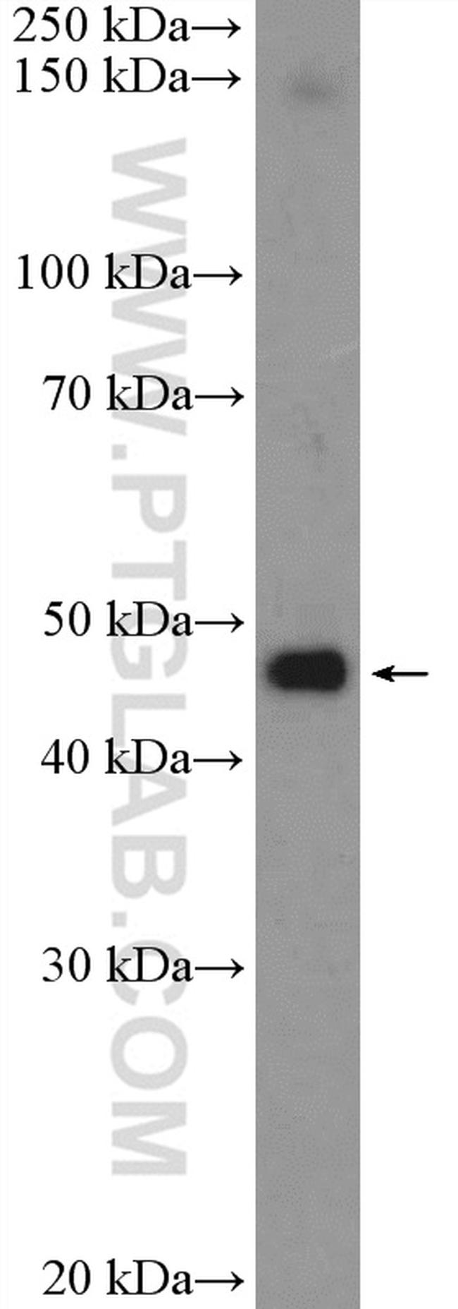 PSMD11 Antibody in Western Blot (WB)