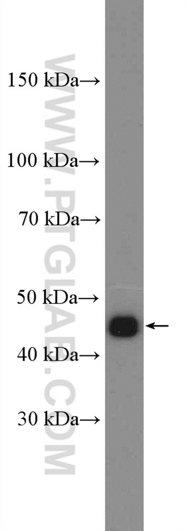 PSMD11 Antibody in Western Blot (WB)