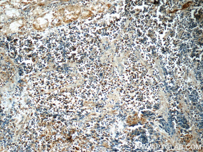 SNRPD2 Antibody in Immunohistochemistry (Paraffin) (IHC (P))