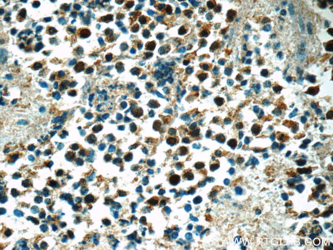 SNRPD2 Antibody in Immunohistochemistry (Paraffin) (IHC (P))