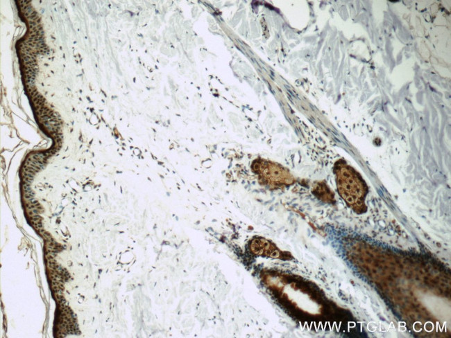 SNRPD2 Antibody in Immunohistochemistry (Paraffin) (IHC (P))