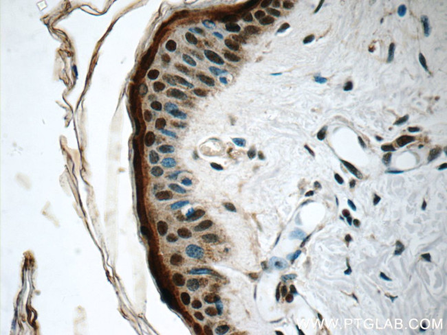 SNRPD2 Antibody in Immunohistochemistry (Paraffin) (IHC (P))