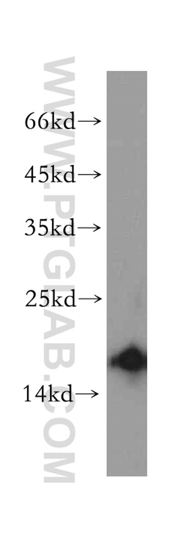 SNRPD2 Antibody in Western Blot (WB)