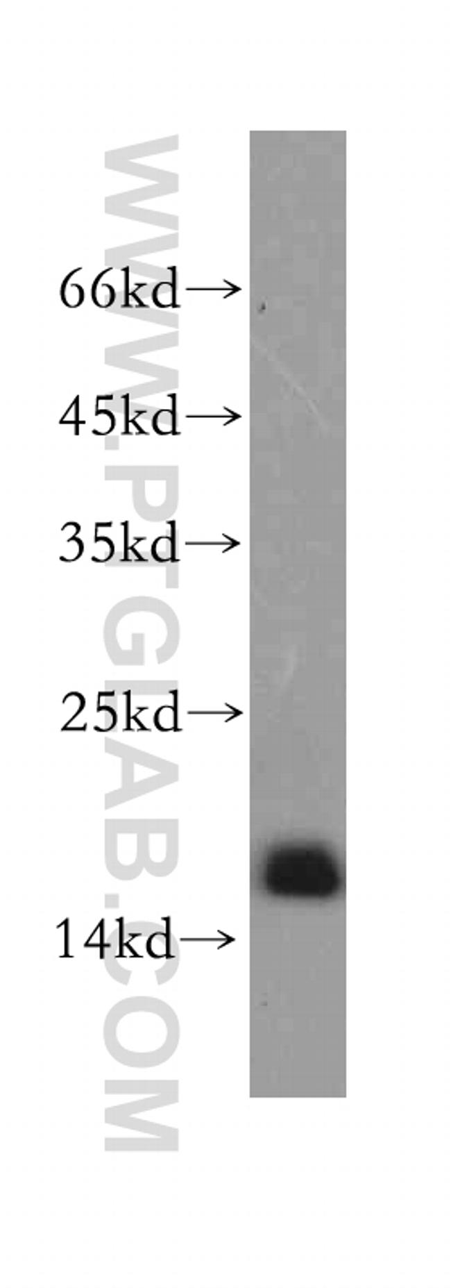 SNRPD2 Antibody in Western Blot (WB)