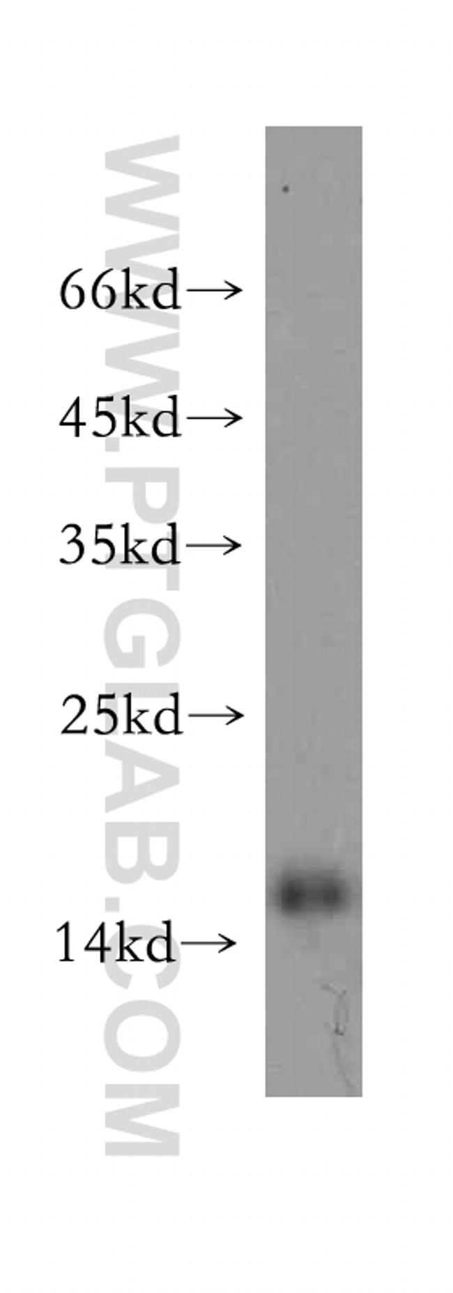 SNRPD2 Antibody in Western Blot (WB)