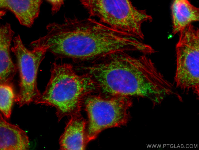 NDUFB8 Antibody in Immunocytochemistry (ICC/IF)