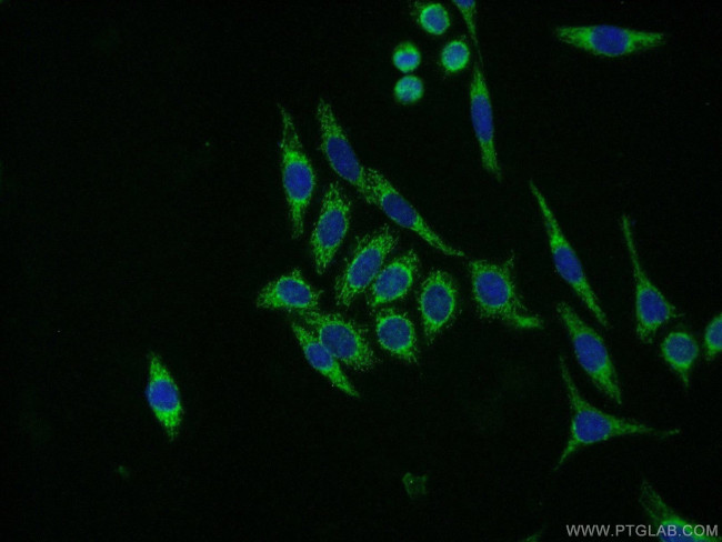 NDUFB8 Antibody in Immunocytochemistry (ICC/IF)