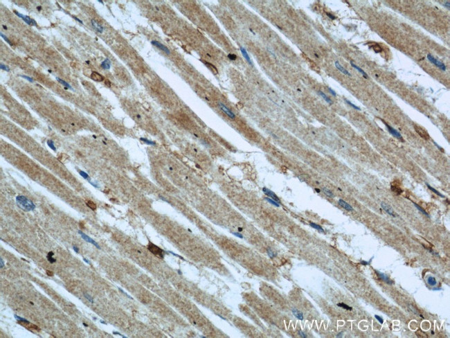 NDUFB8 Antibody in Immunohistochemistry (Paraffin) (IHC (P))