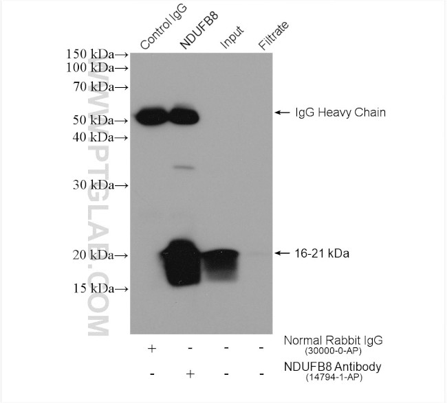 NDUFB8 Antibody in Immunoprecipitation (IP)