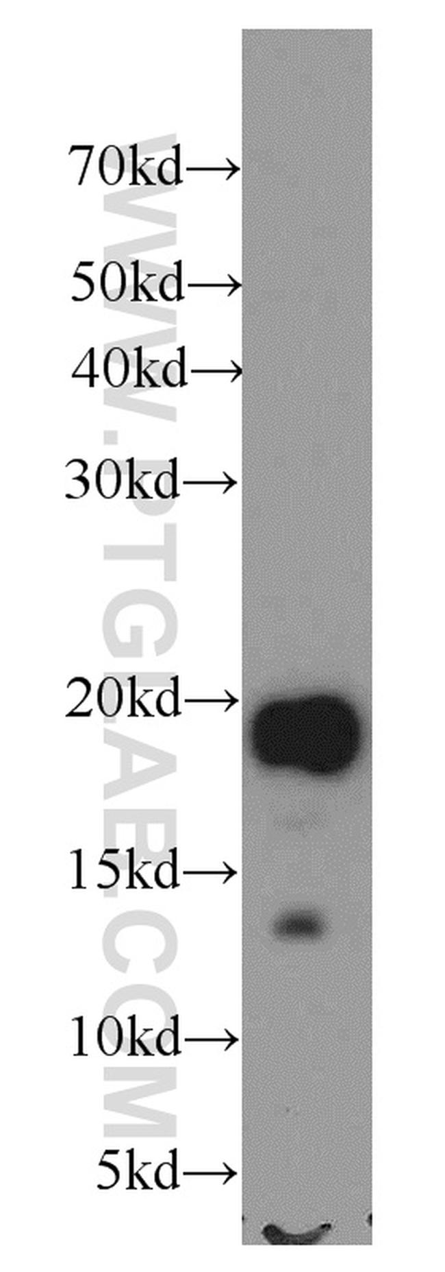 NDUFB8 Antibody in Western Blot (WB)