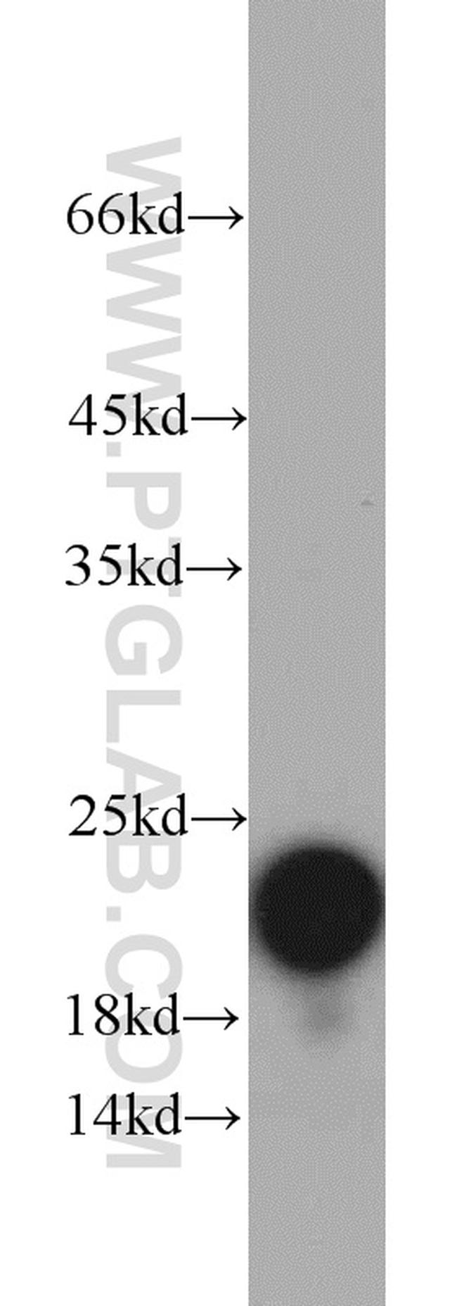 NDUFB8 Antibody in Western Blot (WB)