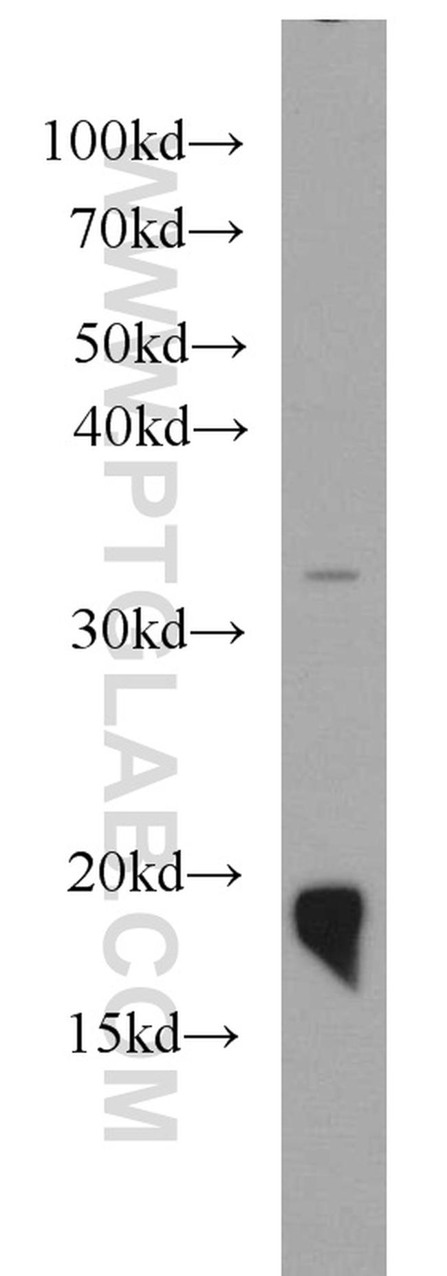 NDUFB8 Antibody in Western Blot (WB)