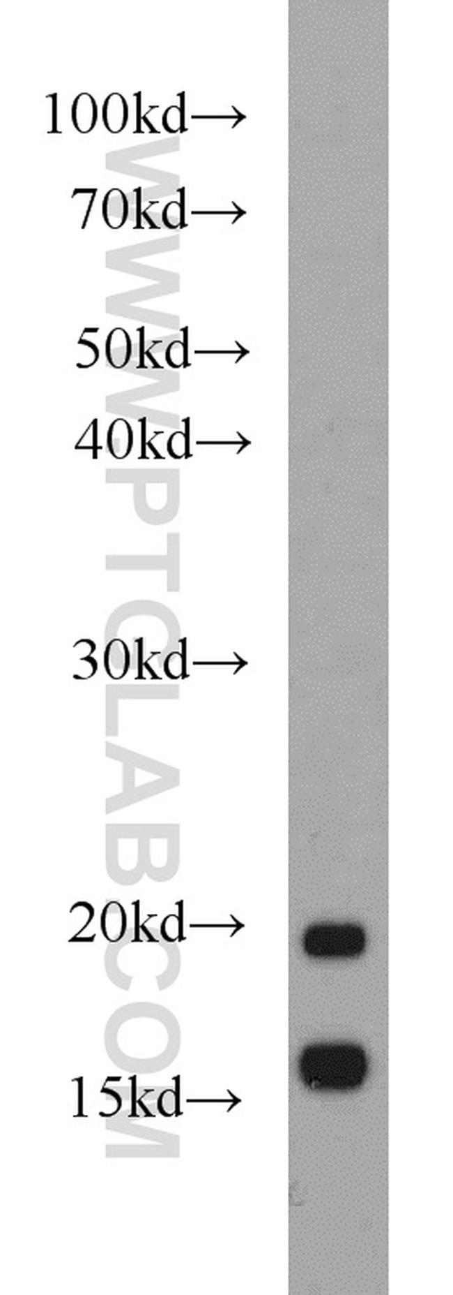 NDUFB8 Antibody in Western Blot (WB)