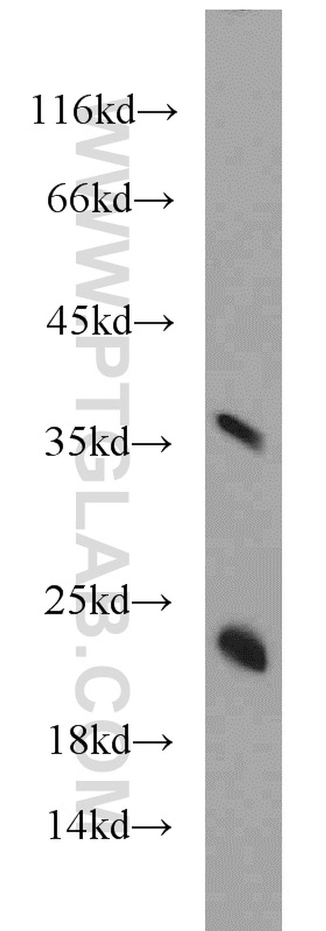 NDUFB8 Antibody in Western Blot (WB)