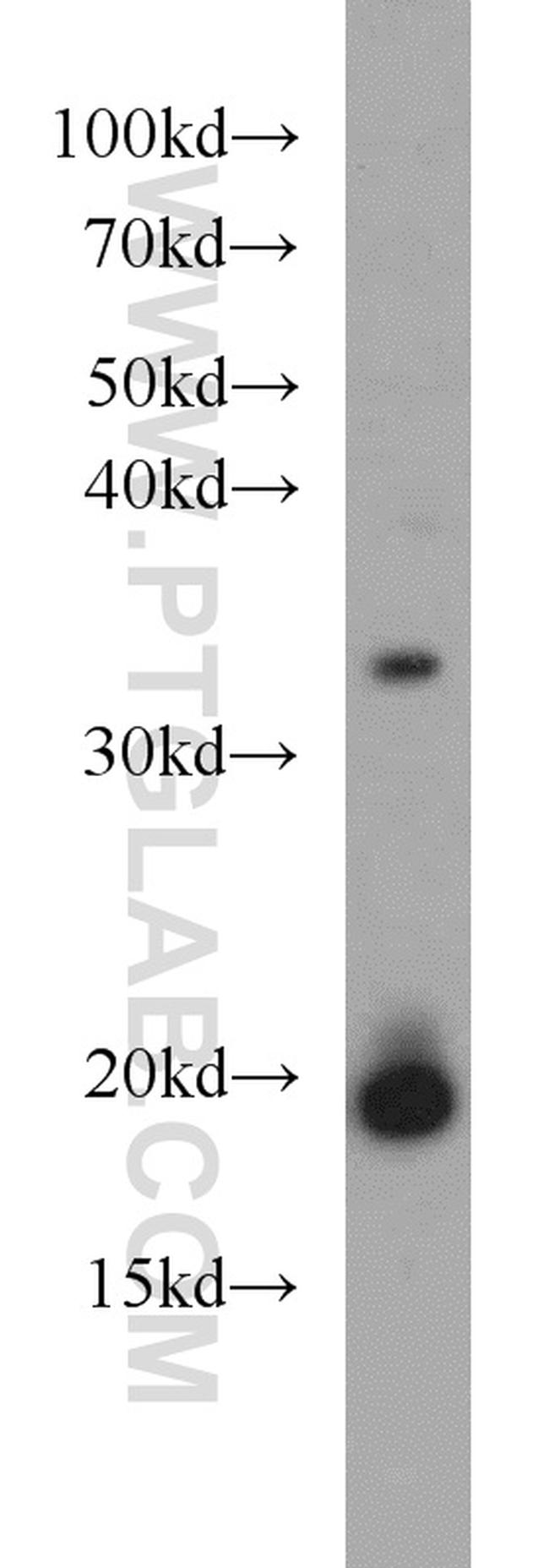 NDUFB8 Antibody in Western Blot (WB)