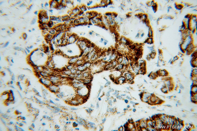 MRPL12 Antibody in Immunohistochemistry (Paraffin) (IHC (P))