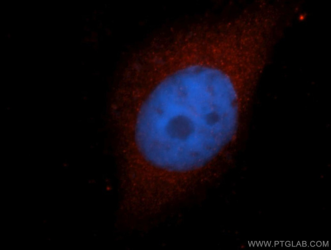 HMBS Antibody in Immunocytochemistry (ICC/IF)