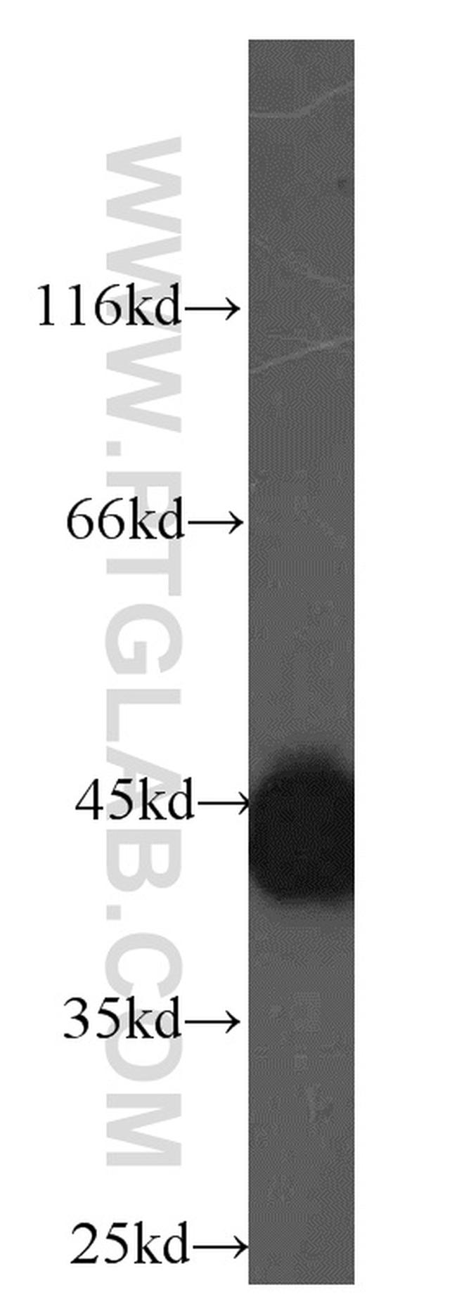 HMBS Antibody in Western Blot (WB)