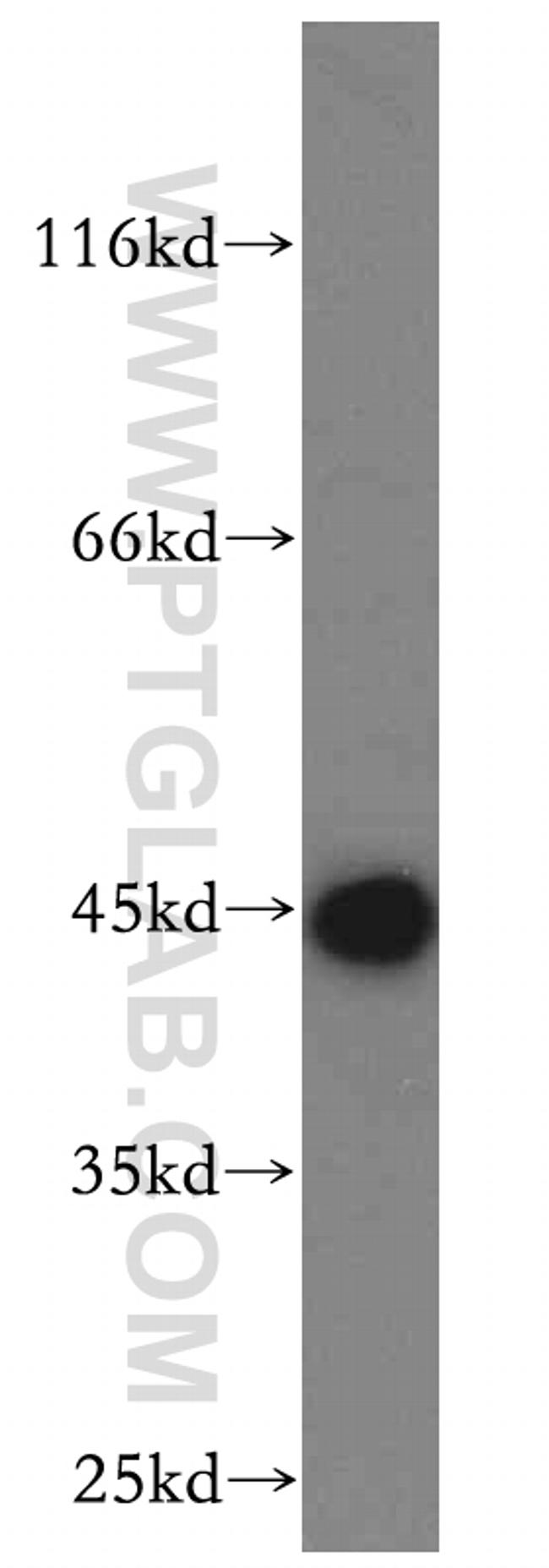 HMBS Antibody in Western Blot (WB)