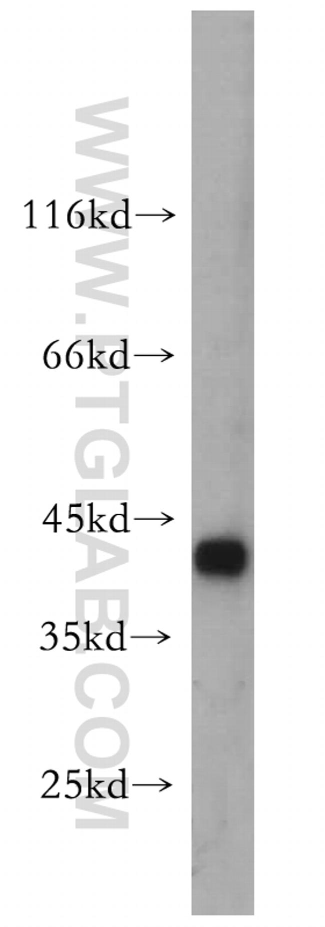 HMBS Antibody in Western Blot (WB)