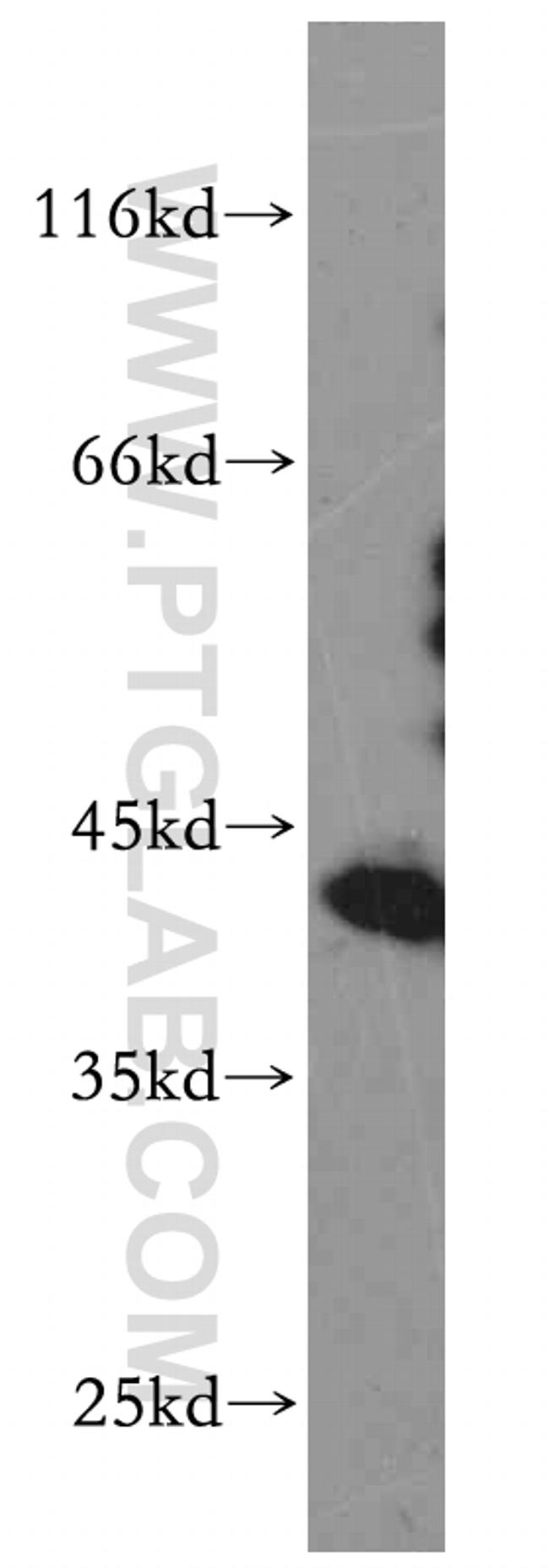 HMBS Antibody in Western Blot (WB)