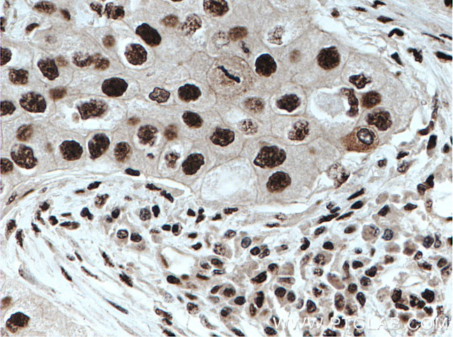 DDX39B Antibody in Immunohistochemistry (Paraffin) (IHC (P))