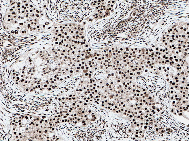 DDX39B Antibody in Immunohistochemistry (Paraffin) (IHC (P))