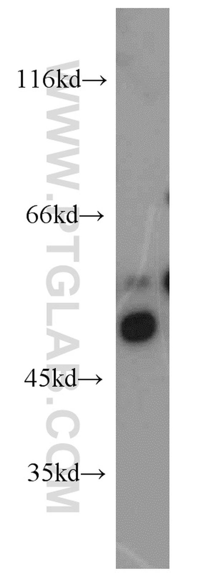 DDX39B Antibody in Western Blot (WB)