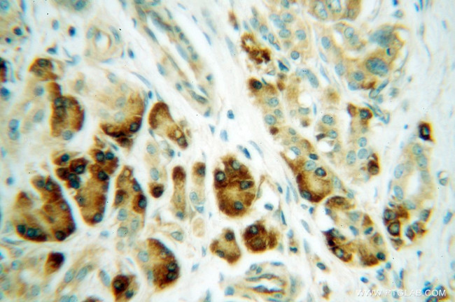 RPS4X Antibody in Immunohistochemistry (Paraffin) (IHC (P))