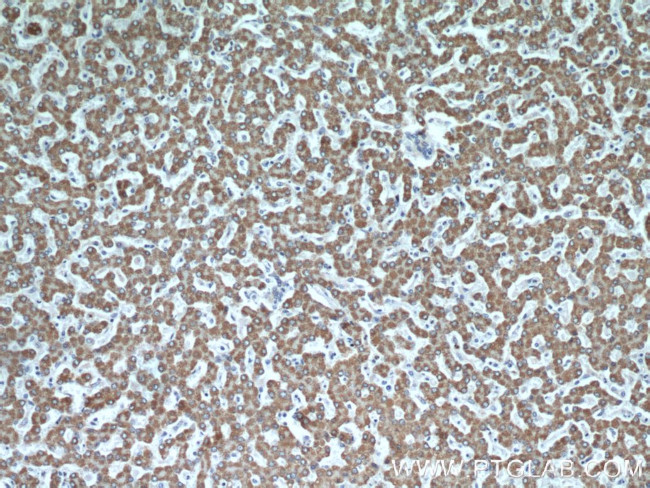 GOT2 Antibody in Immunohistochemistry (Paraffin) (IHC (P))