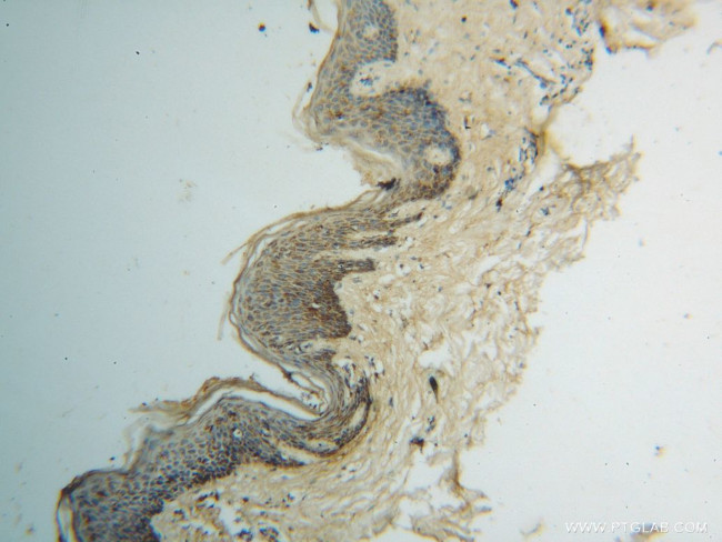 GOT2 Antibody in Immunohistochemistry (Paraffin) (IHC (P))