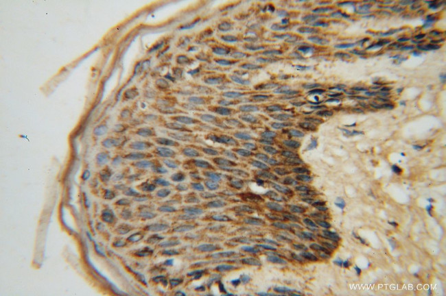 GOT2 Antibody in Immunohistochemistry (Paraffin) (IHC (P))