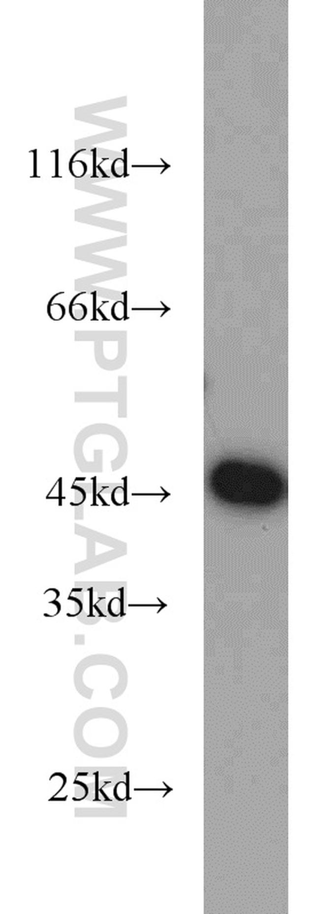 GOT2 Antibody in Western Blot (WB)