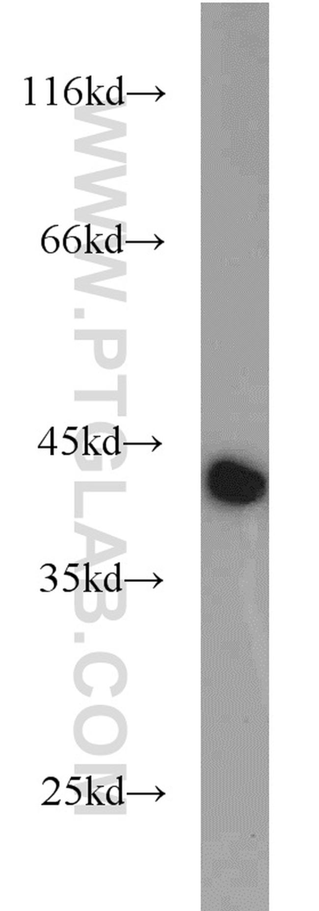 GOT2 Antibody in Western Blot (WB)