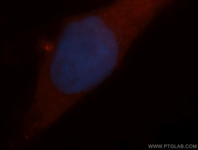 ARD1A Antibody in Immunocytochemistry (ICC/IF)