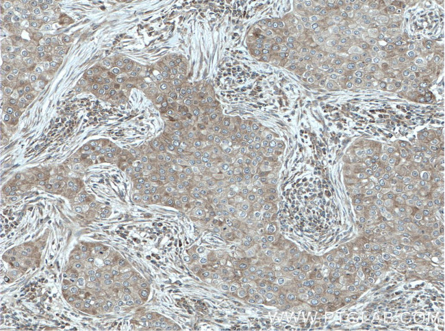 ARD1A Antibody in Immunohistochemistry (Paraffin) (IHC (P))