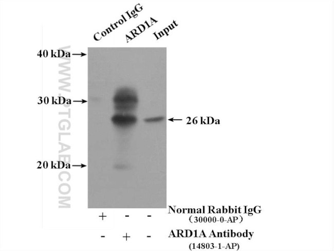 ARD1A Antibody in Immunoprecipitation (IP)